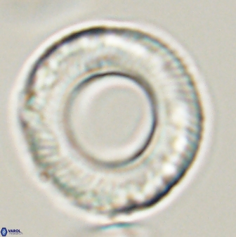 Tonromeinia deniseae 57036