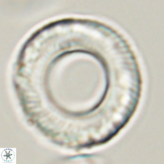 Tonromeinia deniseae 57036