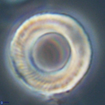 Tonromeinia deniseae 57038