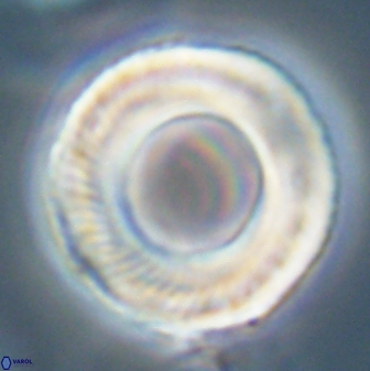 Tonromeinia deniseae 57039