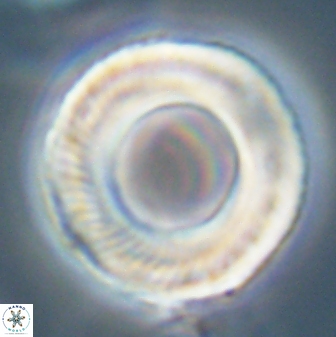 Tonromeinia deniseae 57039