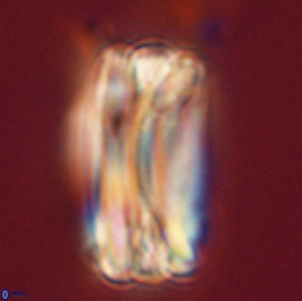 Tonromeinia deniseae 57879