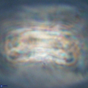 Tonromeinia deniseae 57886