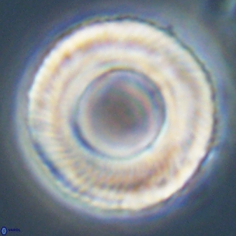 Tonromeinia deniseae 57887