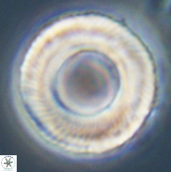 Tonromeinia deniseae 57887