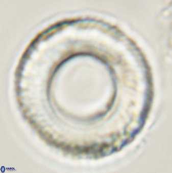 Tonromeinia deniseae 57889