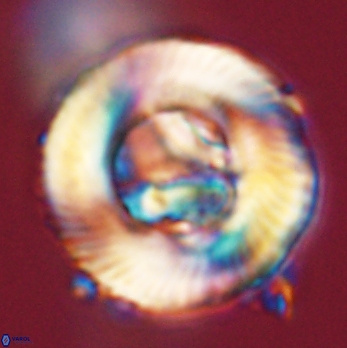 Tonromeinia deniseae 59188