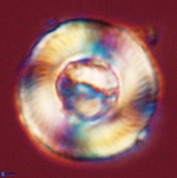 Tonromeinia deniseae 59192