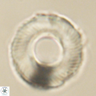 Tonromeinia deniseae 60192
