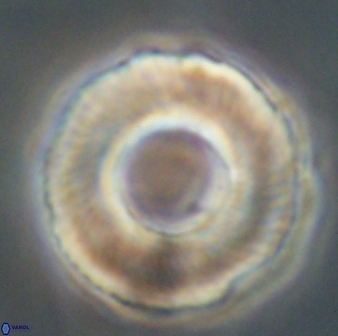 Tonromeinia deniseae 60194