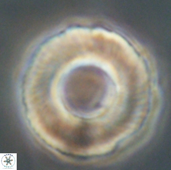 Tonromeinia deniseae 60194