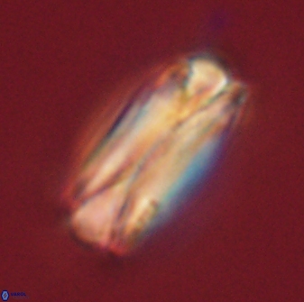 Tonromeinia deniseae 60201