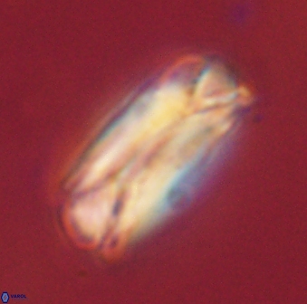 Tonromeinia deniseae 60207