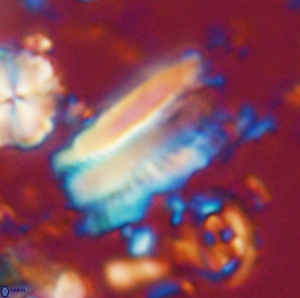 Tonromeinia deniseae 21450