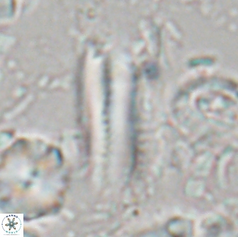 Tonromeinia deniseae 21452