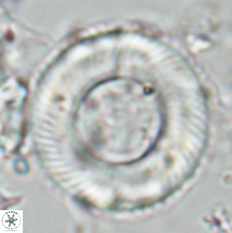 Tonromeinia deniseae 25221