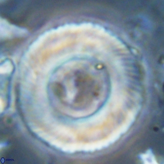 Tonromeinia deniseae 25222