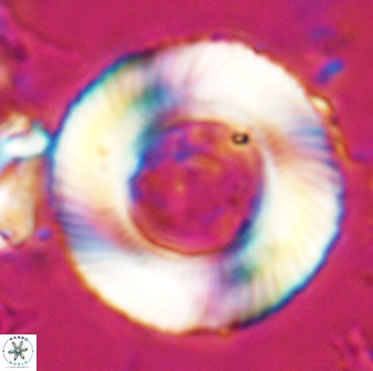 Tonromeinia deniseae 25224