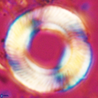 Tonromeinia deniseae 25393