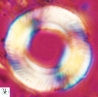 Tonromeinia deniseae 25393
