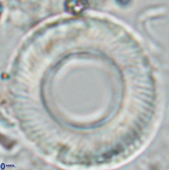 Tonromeinia deniseae 25396