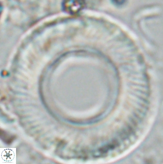 Tonromeinia deniseae 25396