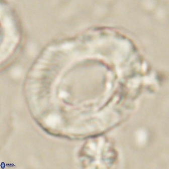 Tonromeinia noeliae 60215