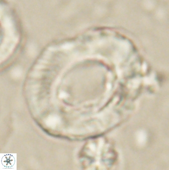 Tonromeinia noeliae 60215