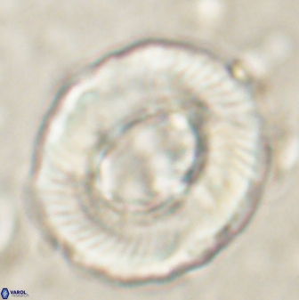 Tonromeinia noeliae 60260