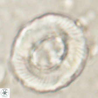 Tonromeinia noeliae 60260