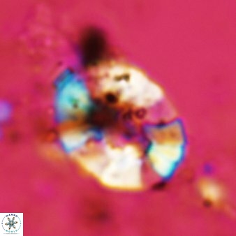 Tortolithus johannisbergensis 522