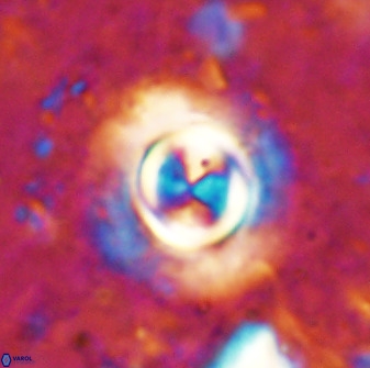 Toweis atalikii 49292