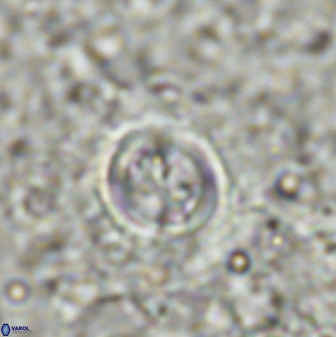 Toweis atalikii 49295