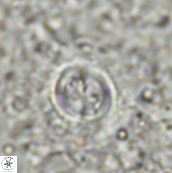 Toweis atalikii 49295
