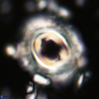 Toweius magnicrassus VR 025644