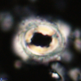 Toweius magnicrassus VR 025645