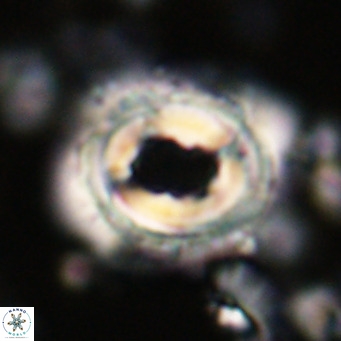 Toweius magnicrassus VR 025645