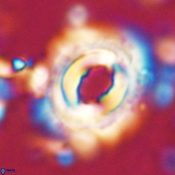 Toweius magnicrassus VR 025647