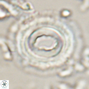 Toweius magnicrassus VR 025651