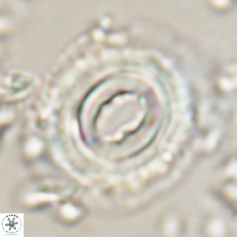 Toweius magnicrassus VR 025652