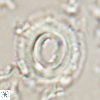 Toweius magnicrassus VR 025653