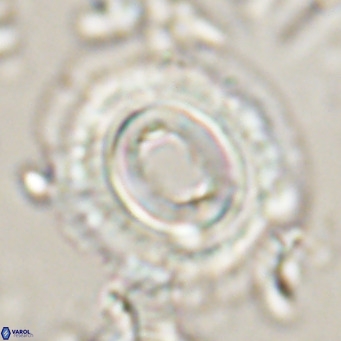 Toweius magnicrassus VR 025654