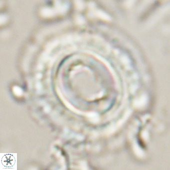 Toweius magnicrassus VR 025654