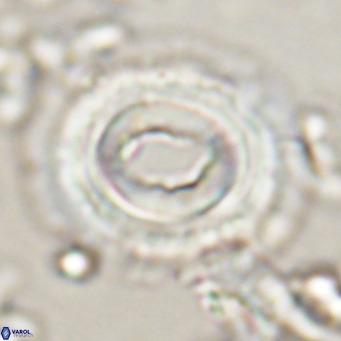 Toweius magnicrassus VR 025655