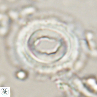 Toweius magnicrassus VR 025655