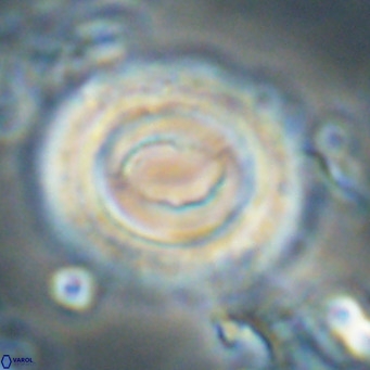 Toweius magnicrassus VR 025656