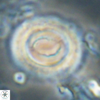 Toweius magnicrassus VR 025656