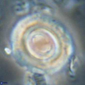 Toweius magnicrassus VR 025657