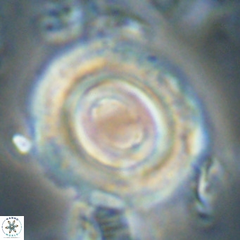Toweius magnicrassus VR 025657