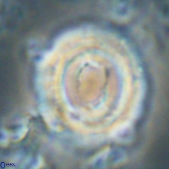Toweius magnicrassus VR 025658
